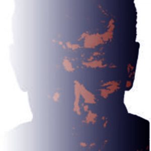 single-image